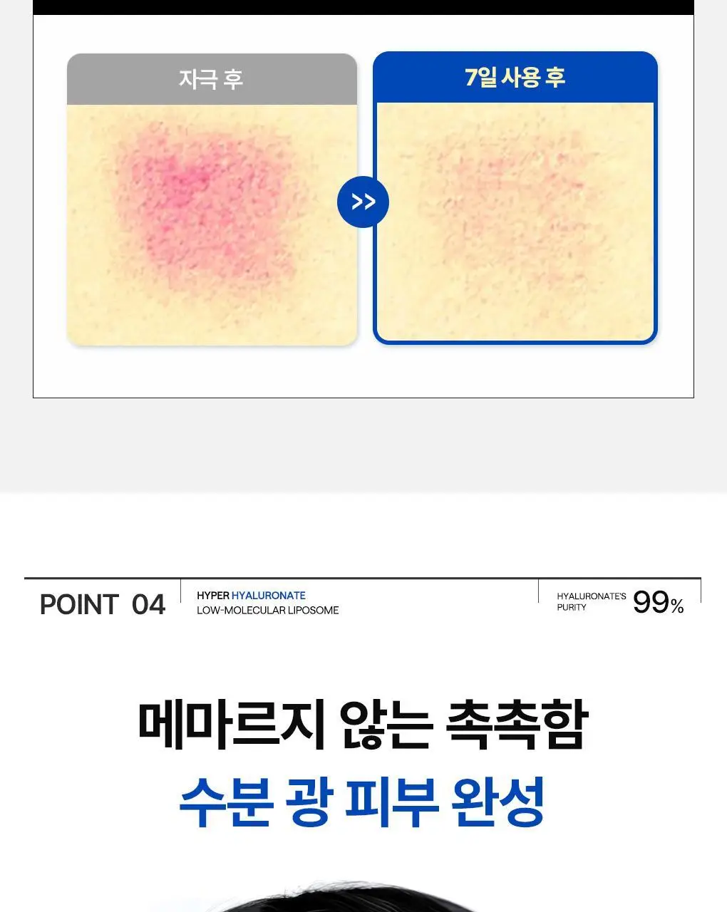 [겔마스크/10매] 메디힐 하이퍼 마스크 3종 (콜라겐/PDRN/히알루론산) 상세페이지 39